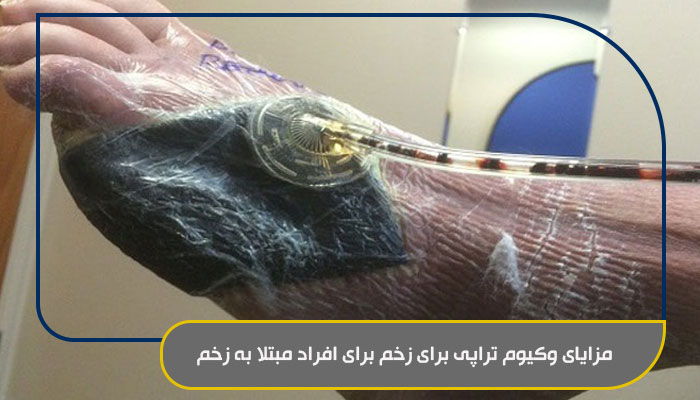 وکیوم تراپی زخم؛ درمانی موثر و سریع 2 مزایای وکیوم تراپی برای زخم برای افراد مبتلا به زخم