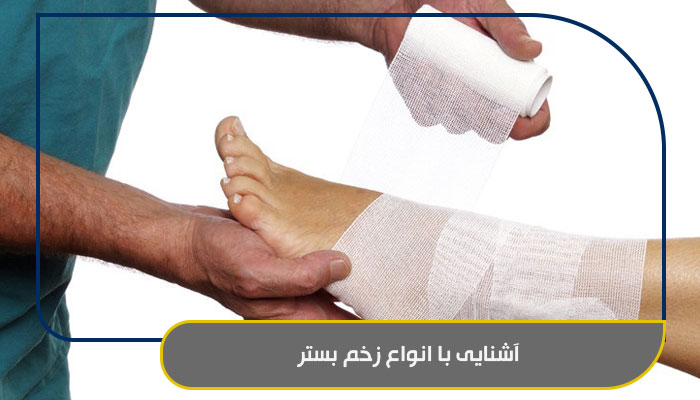 آشنایی با انواع زخم بستر