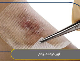 لیزر درمانی زخم
