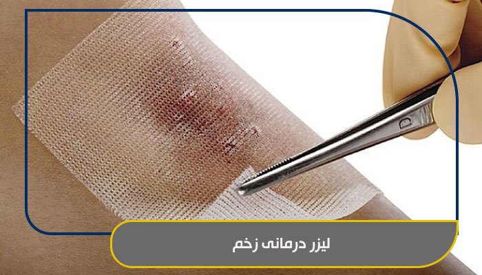 لیزر درمانی زخم