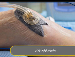 وکیوم تراپی زخم