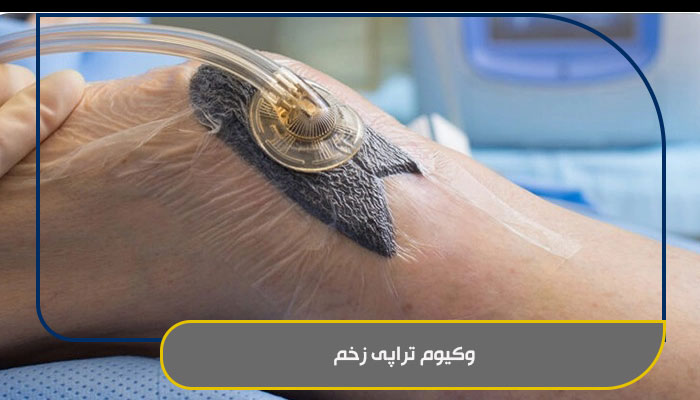 وکیوم تراپی زخم