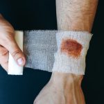 درمان تخصصی عفونت زخم: رویکردها و استراتژی‌ها