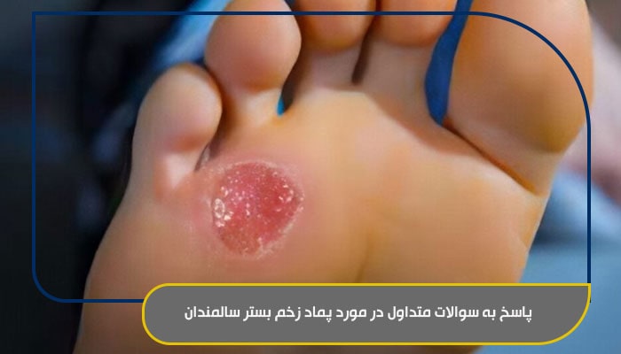 پاسخ به سوالات متداول در مورد پماد زخم بستر سالمندان