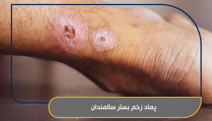 پماد زخم بستر سالمندان