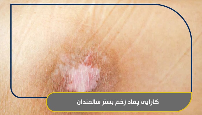 کارایی پماد زخم بستر سالمندان