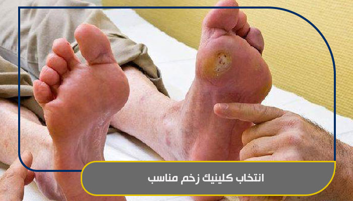 همه چیز در مورد خدمات کلینیک زخم 3 انتخاب کلینیک زخم مناسب