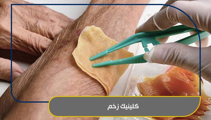 همه چیز در مورد خدمات کلینیک زخم 1 کلینیک زخم