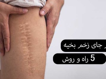 ترمیم جای زخم بخیه 5 راه‌ و روش‌