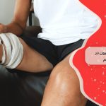 آمپوتاسیون در کلینیک زخم 5 فرآیند